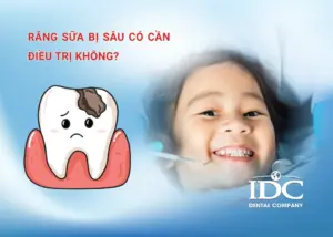 Nhổ răng sữa khi nào cần thiết? Những điều cha mẹ cần biết