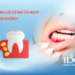 Sưng lợi có mủ có nguy hiểm không?
