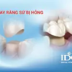 thay rang su bi hog