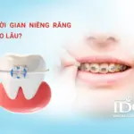 thoi gian nieng rang bao lau