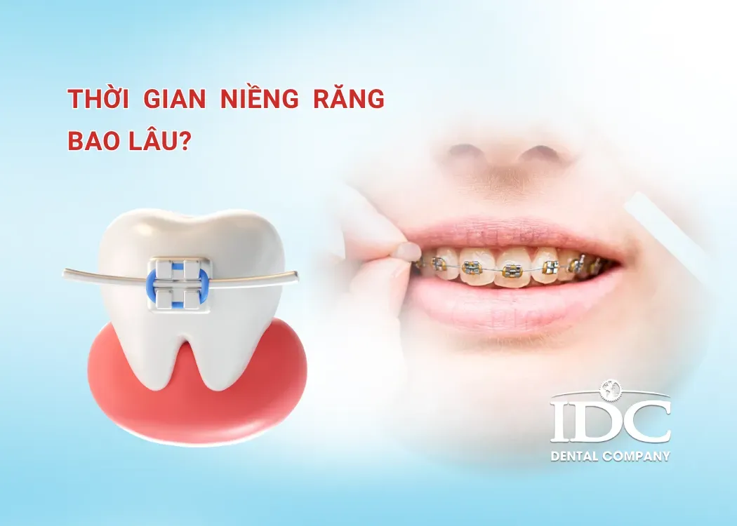 thoi gian nieng rang bao lau