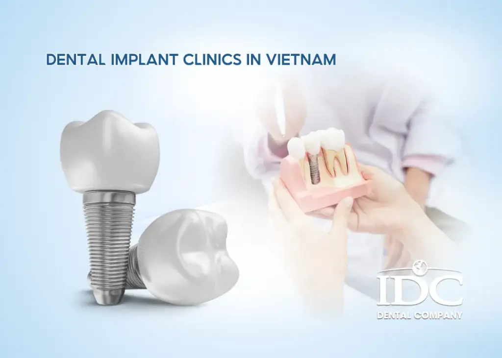 Top 9 Dental Implant Clinics in Vietnam