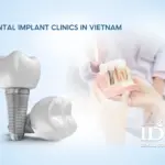 Dental Implant Clinics in Vietnam