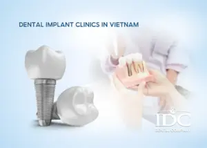 Trusted Dental Clinics with English-Speaking Staff in Da Nang City