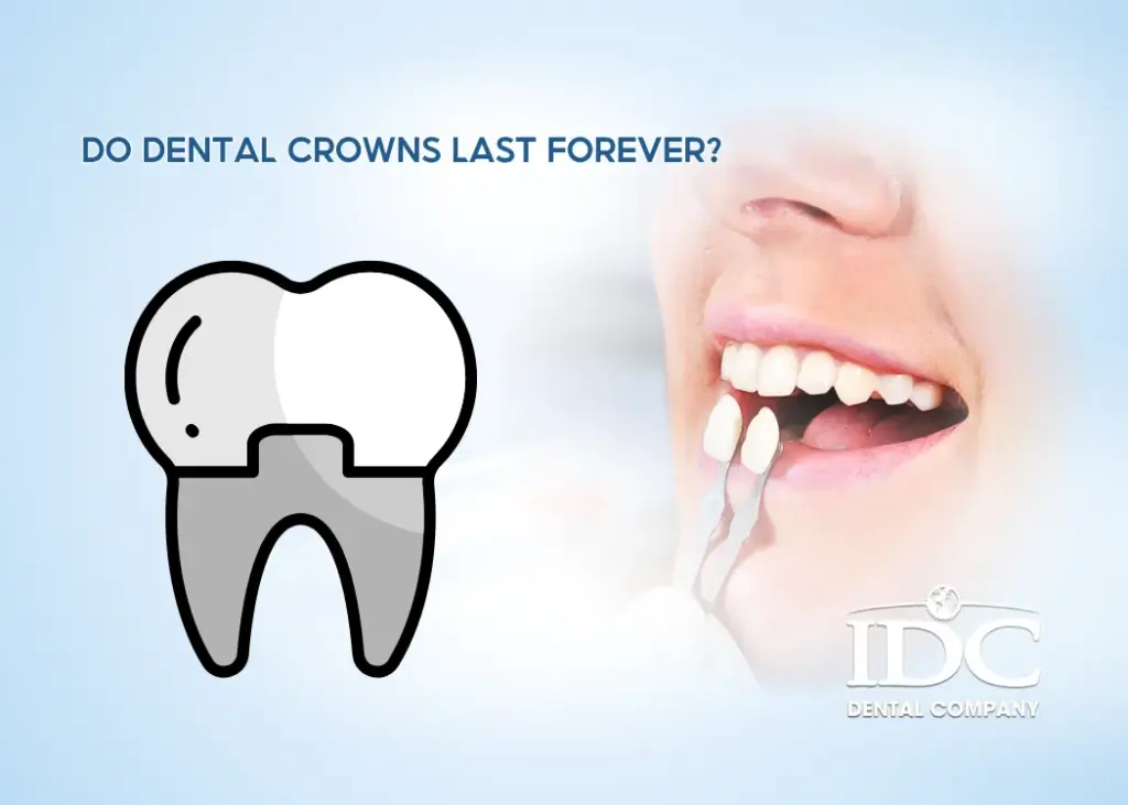 Do dental crowns last forever?