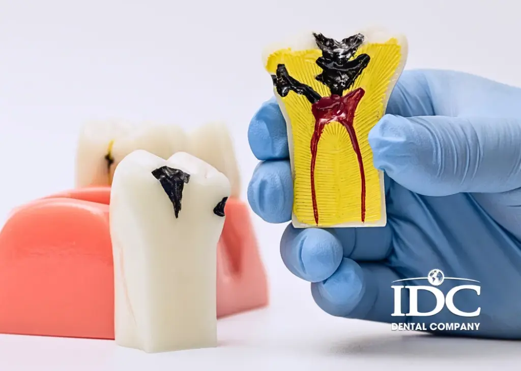 How Does Tooth Decay Progress?