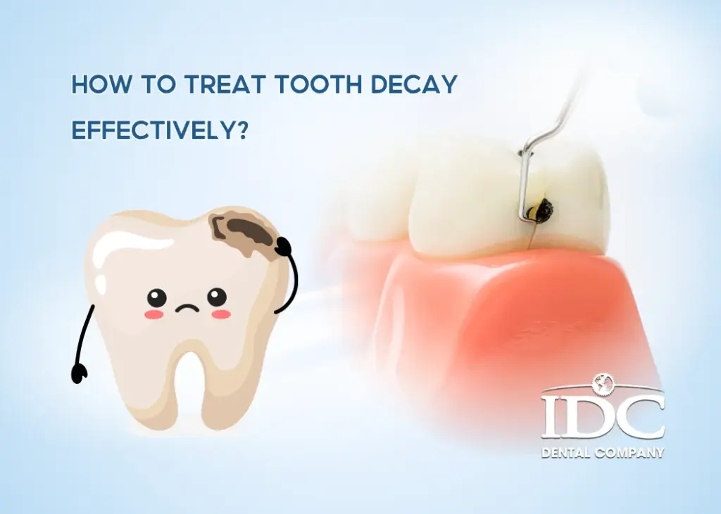 How to Treat Tooth Decay Effectively? 