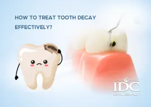 Post-Treatment Care for a Gummy Smile: Essential Tips You Shouldn’t Miss