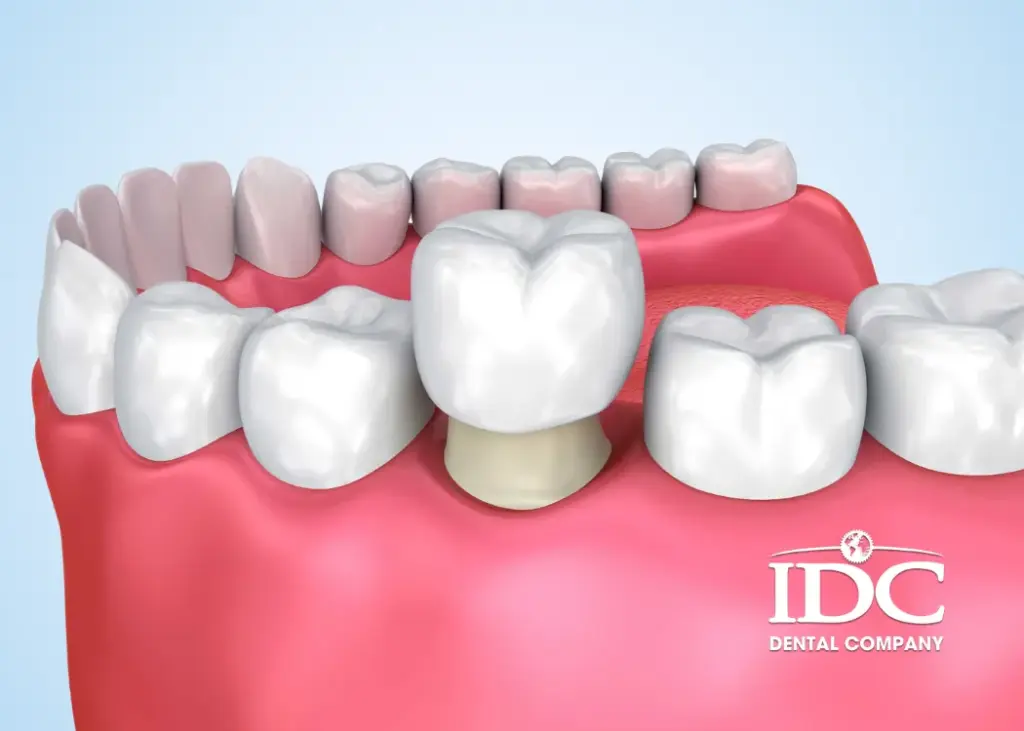 Tooth Pain After a Dental Crown: Normal vs. Abnormal Crown Pain