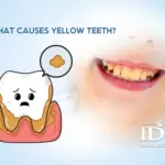 What Causes Yellow Teeth