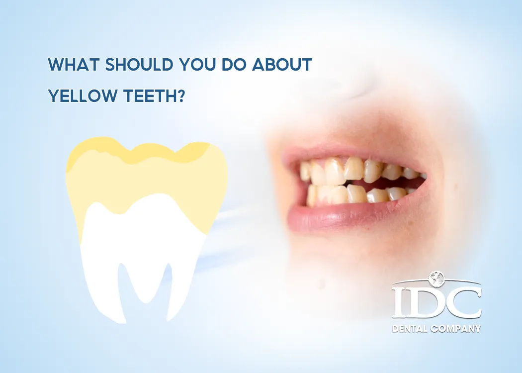 What should you do about yellow teeth?