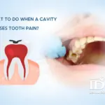 What to Do When a Cavity Causes Tooth Pain?