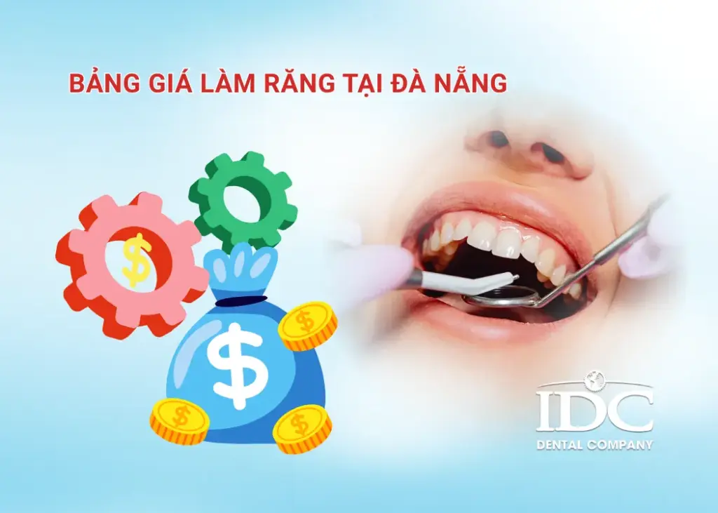 Bảng giá làm răng tại Đà Nẵng