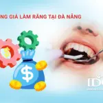 Bảng giá làm răng tại Đà Nẵng