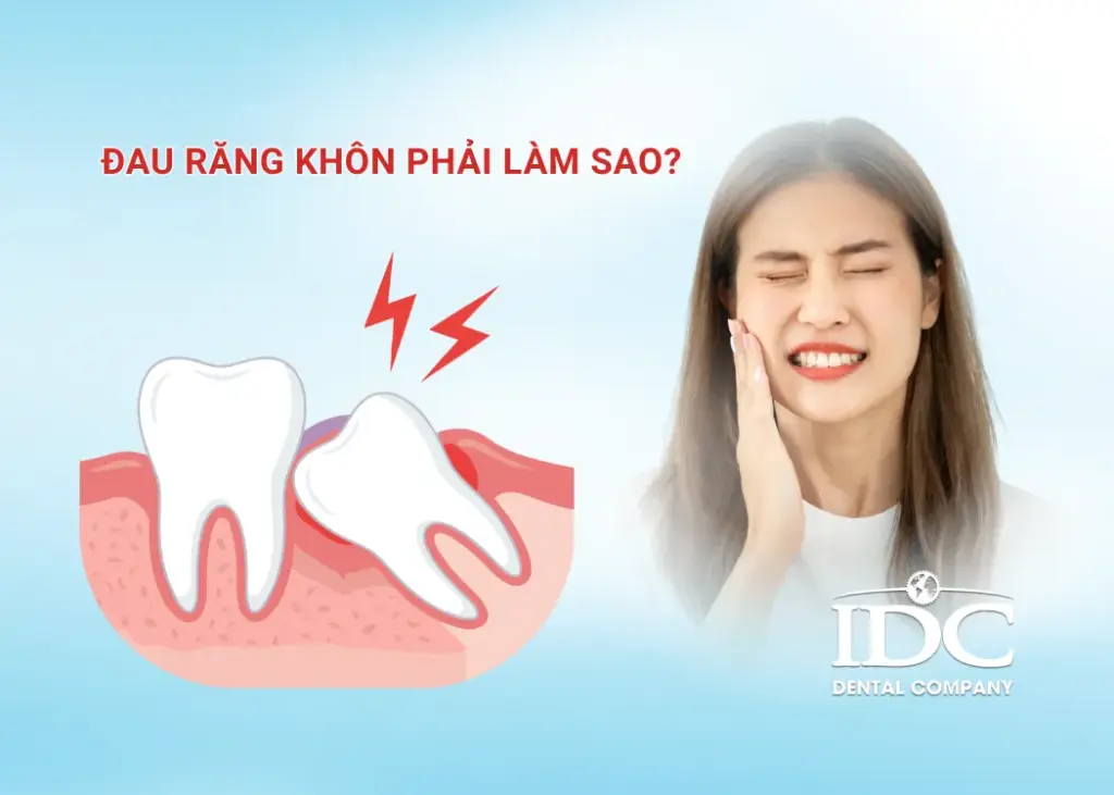 Đau răng khôn phải làm sao?