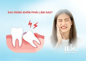 Làm răng sứ Cercon có tốt không? Giải đáp của chuyên gia