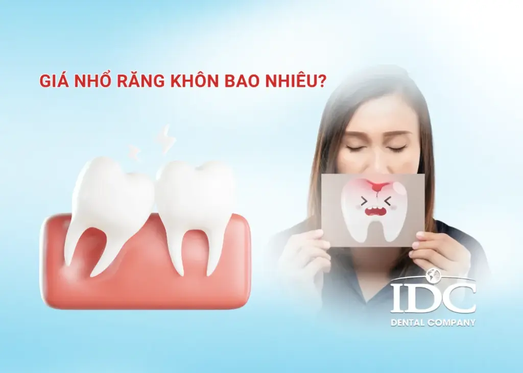 Giá nhổ răng khôn bao nhiêu