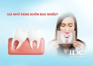 Làm răng sứ Cercon có tốt không? Giải đáp của chuyên gia