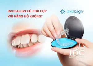 Sâu răng đau nhức phải làm sao? 10 Cách xử lý hiệu quả tại nhà và phòng khám