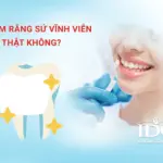 Làm răng sứ vĩnh viễn có thật không?