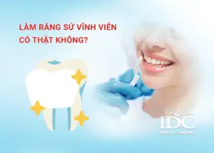 Những người không nên niềng răng: 7 Trường hợp cần cân nhắc kỹ