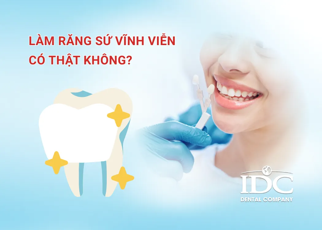 Làm răng sứ vĩnh viễn có thật không?