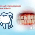 Làm răng sứ xong bị nhức có sao không?