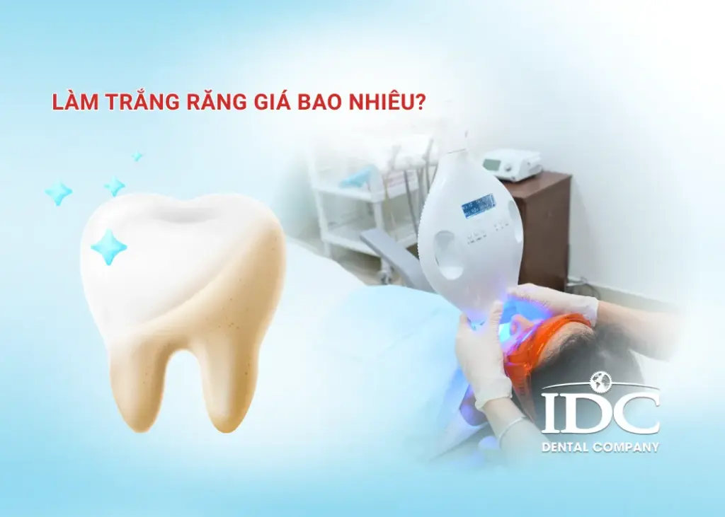 Làm trắng răng giá bao nhiêu? 