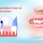 rang khenh co boc su duoc khong
