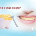 rang o vang do dau