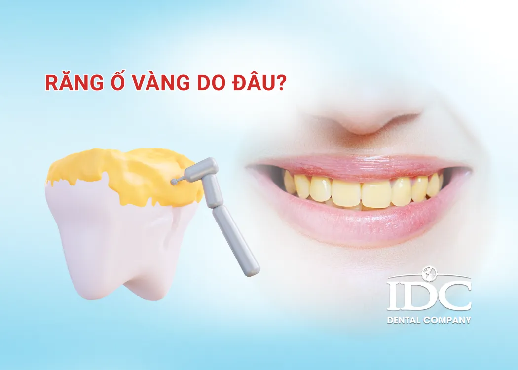 rang o vang do dau
