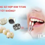 Răng sứ hợp kim titan có tốt không?