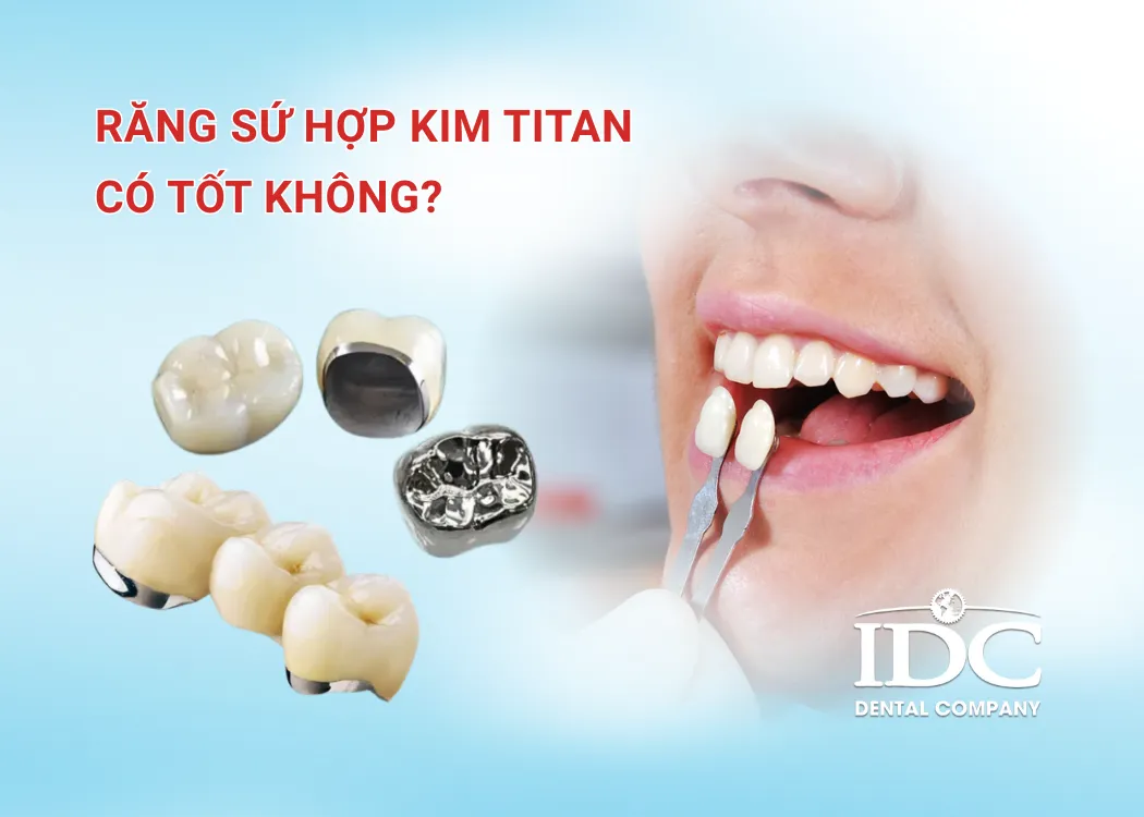 Răng sứ hợp kim titan có tốt không?