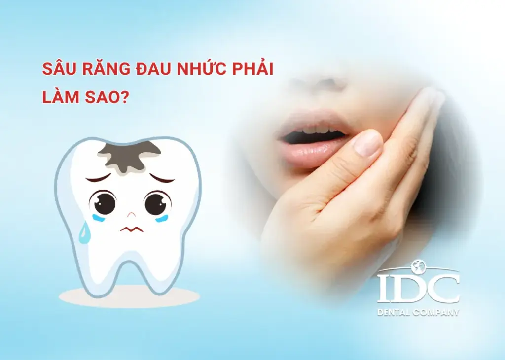 Sâu răng đau nhức phải làm sao?