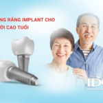 trong rang implant cho nguoi cao tuoi