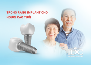 Trồng răng implant All-on-4 là gì? Giá bao nhiêu tại Đà Nẵng?