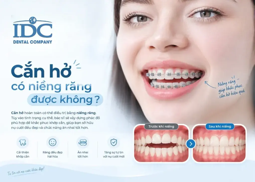 Cắn hở có niềng răng được không?