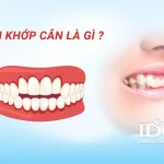 Sai khớp cắn