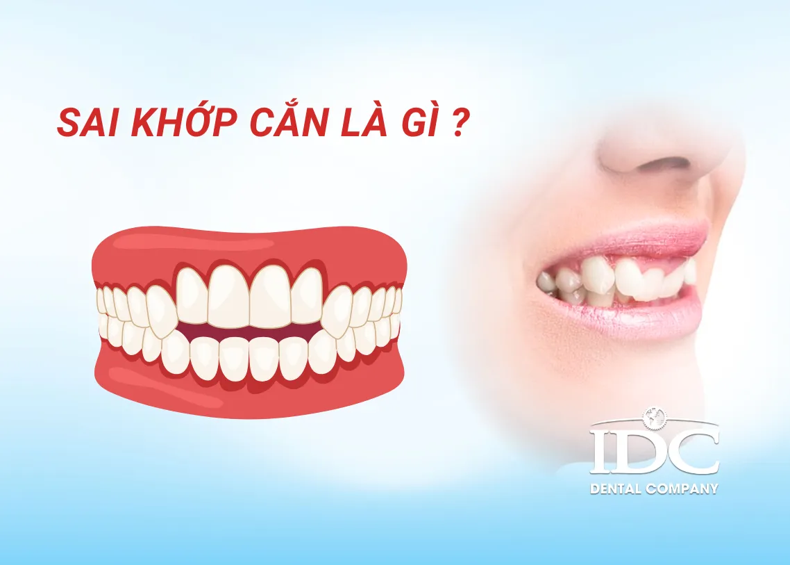 Sai khớp cắn