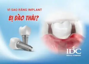 Răng ố vàng do đâu? Cách làm trắng răng an toàn và hiệu quả