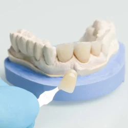 Aesthetic Crowns & Veneers