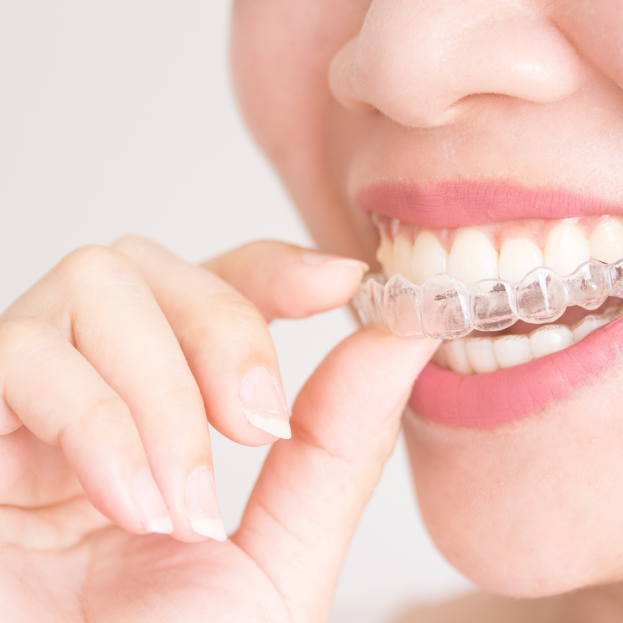 GSD-Straighten-Your-Teeth-with-Invisalign®-Clear-Aligners-Blog