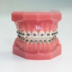 nieng rang mac cai_5_11zon